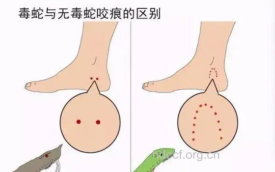 各种动物刺伤的急救秘诀
