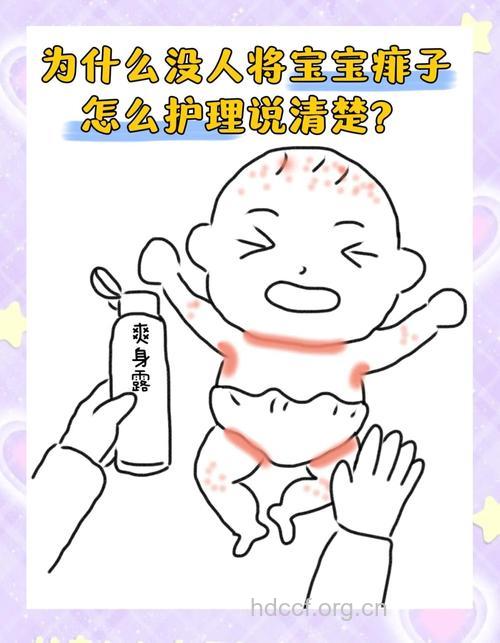 夏天到 谨防孩子误服痱子粉