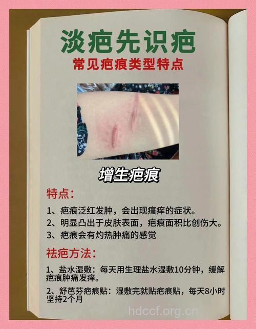 中医祛疤痕的方法