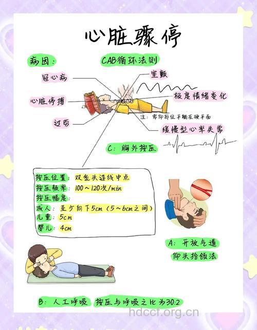 心脏骤停急救的6个关键点