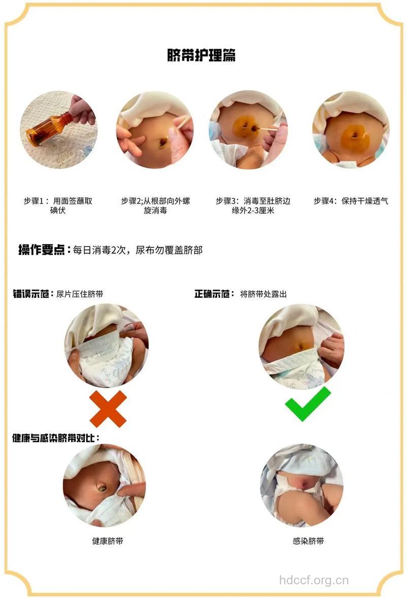 怎么呵护新生儿肚脐眼健康
