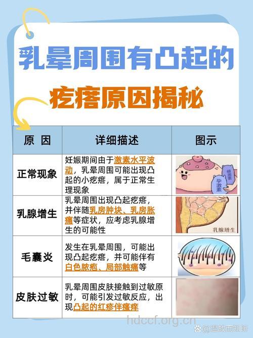 丰胸乳晕为什么会长粉刺