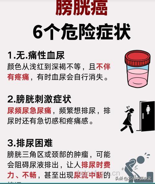 9个中药偏方治疗膀胱癌