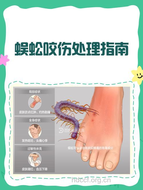 蜈蚣咬伤后怎样处理