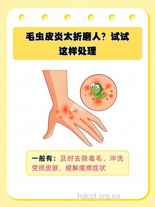 被毛毛虫蛰伤怎么办