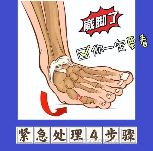 崴脚的中医治疗方法