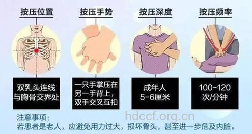 徒手复苏术能降猝死率的解析