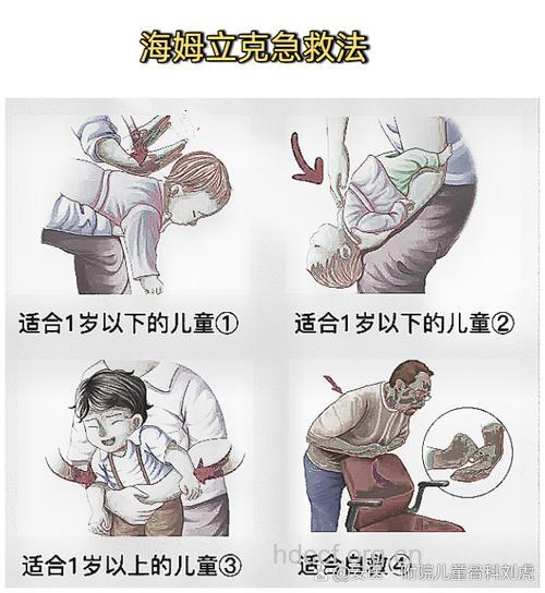 2岁幼儿被软糖卡喉离世 家长要学会如何急救