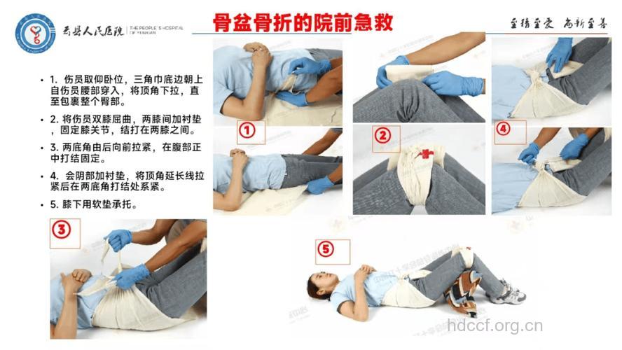 腿骨、脊柱和骨盆骨折怎么急救