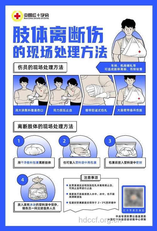 断肢的急救及处理方法