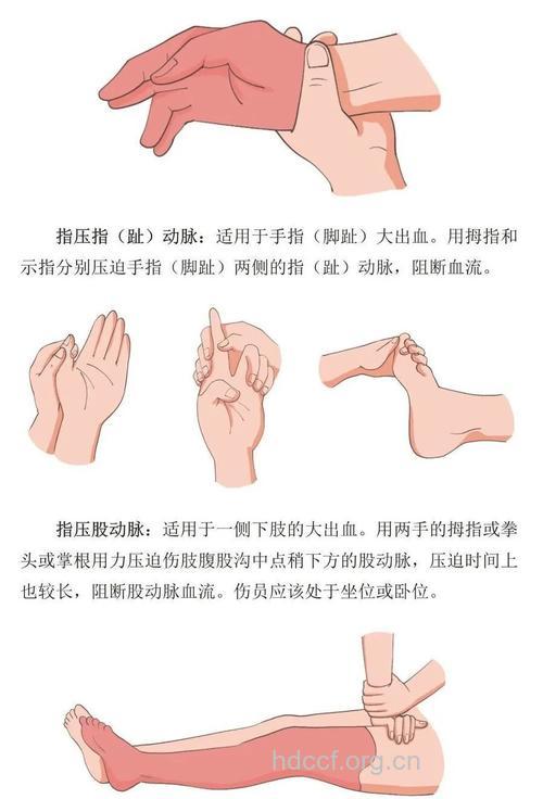 急救指压止血大法