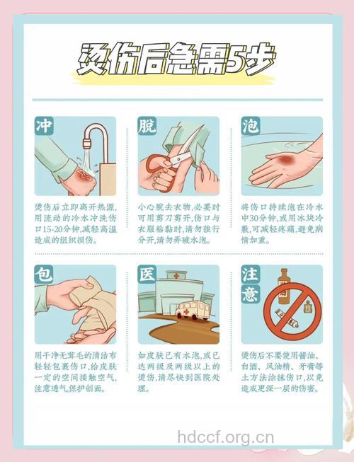 家庭烫伤后的正确处理措施