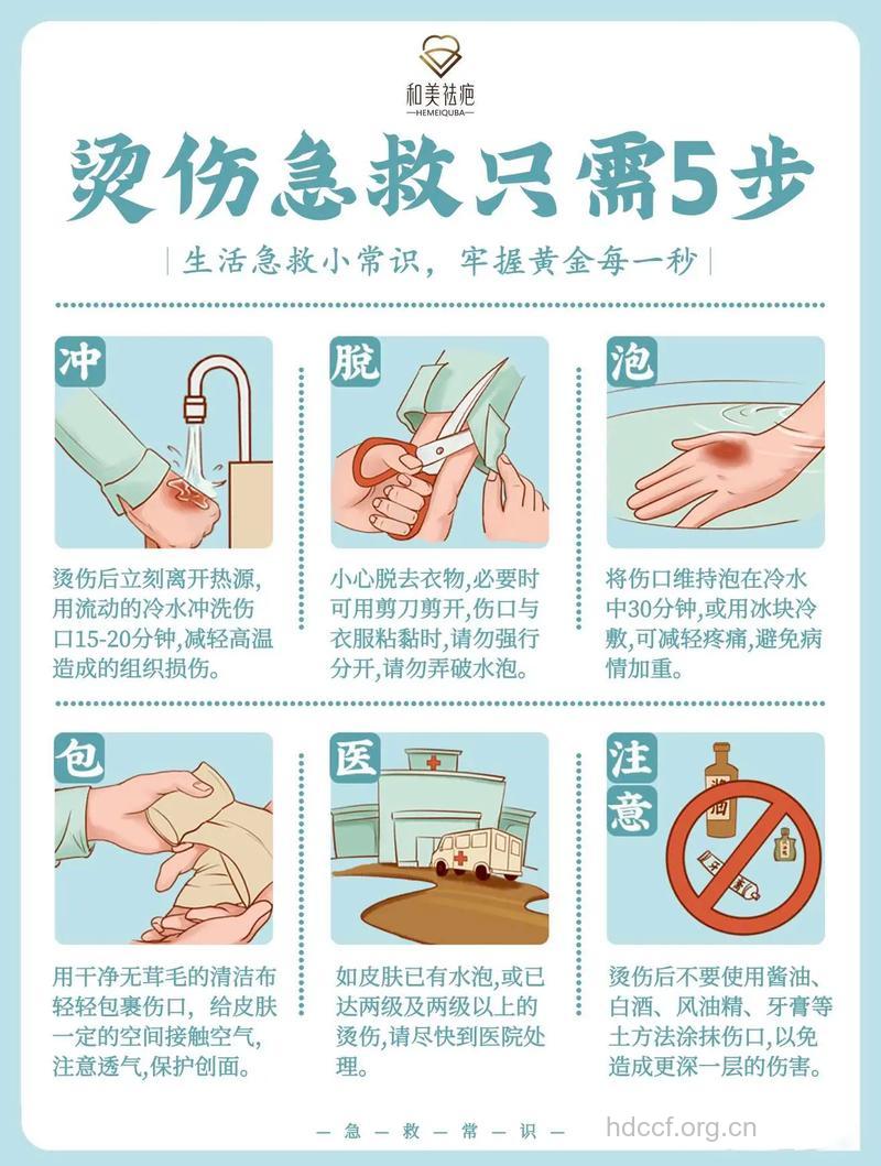 一次额外的温暖和我的烫伤急救故事