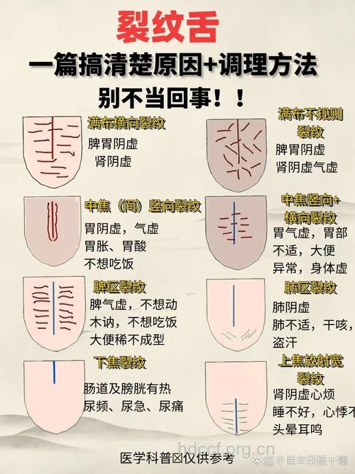 中医：舌头有裂纹是怎么回事？