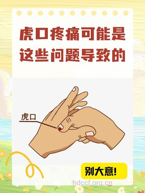 牙疼难耐 试试虎口拔罐