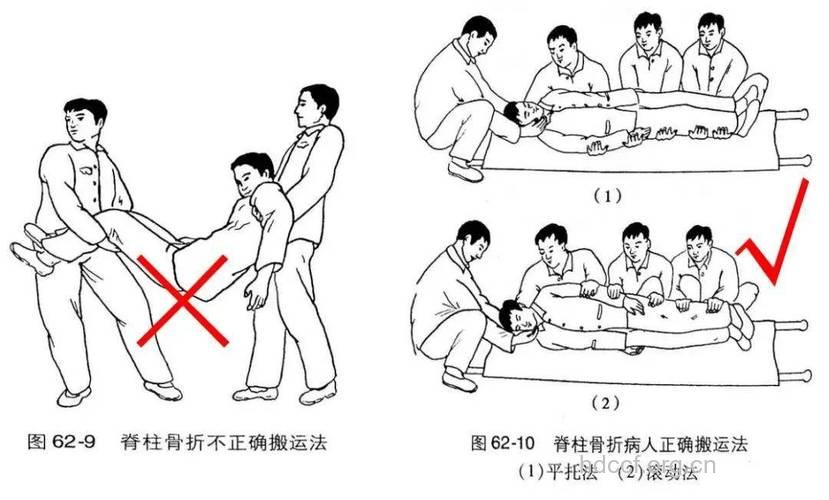 搬运伤者常用方法