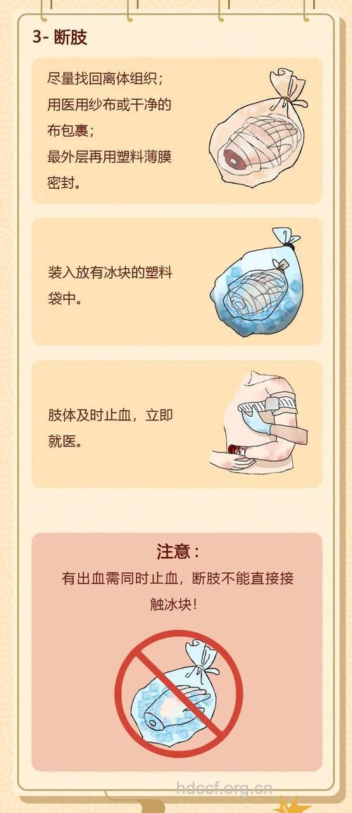 断肢的急救常识