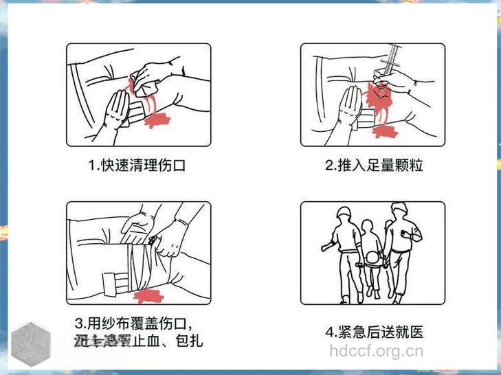 大量出血如何进行急救