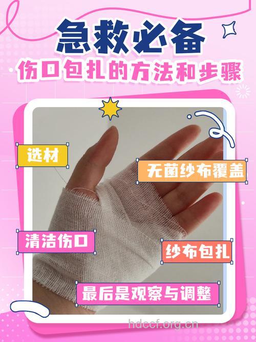 外伤包扎的注意事项