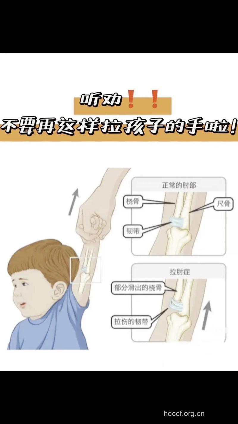 儿童关节脱臼该什么办