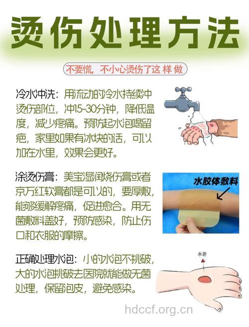 烧烫伤后,千万别用"土方法"
