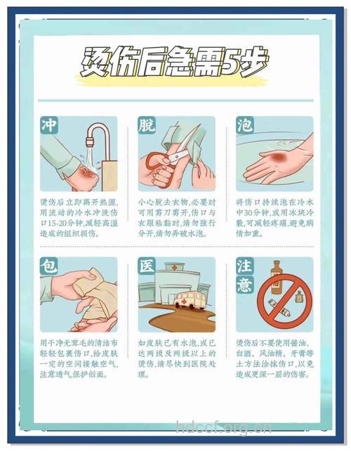 烧伤后如何正确处理