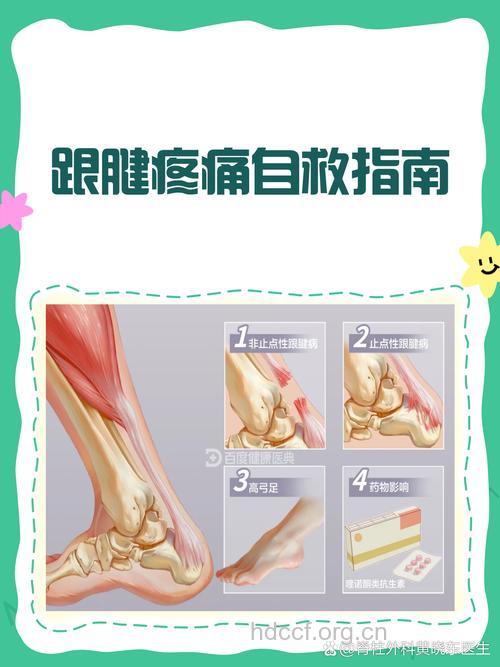 跟腱损伤的急救方法