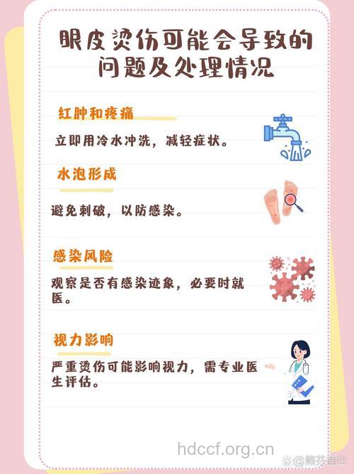 眼部烧伤有什么急救原则