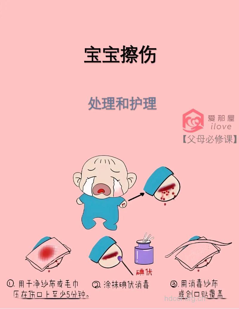 擦皮伤也需要处理不容忽视
