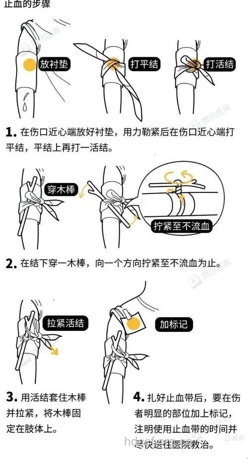 受伤出血了怎样快速止血