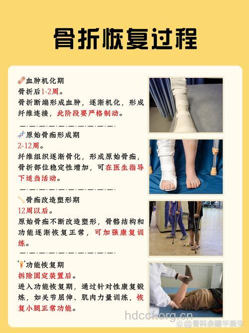 骨折后有哪些注意事项