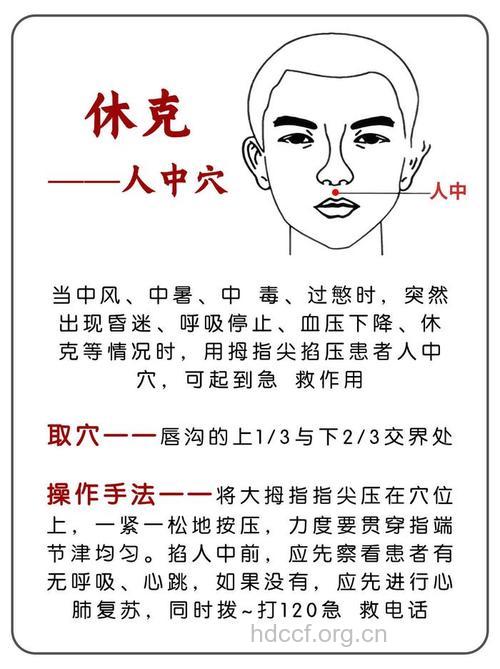 “人中穴”有什么急救作用