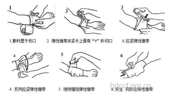 急救现场：止血带该如何使用？