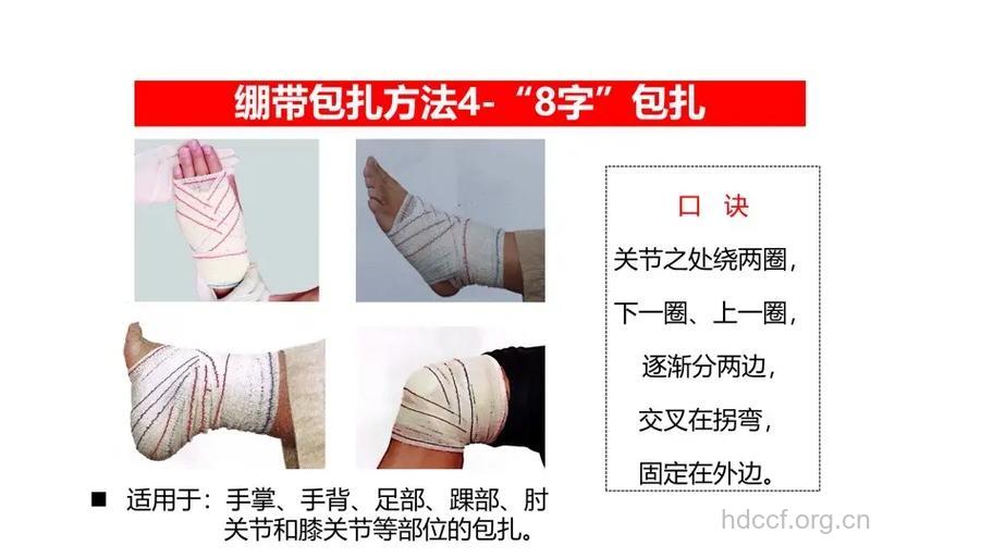常识：伤口包扎的5个误区