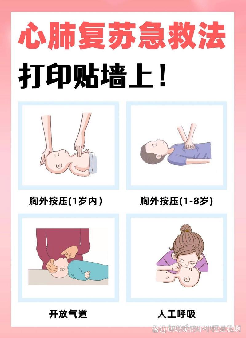 婴儿心肺复苏的全过程
