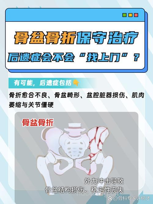 骨盆骨折了该怎么办呢