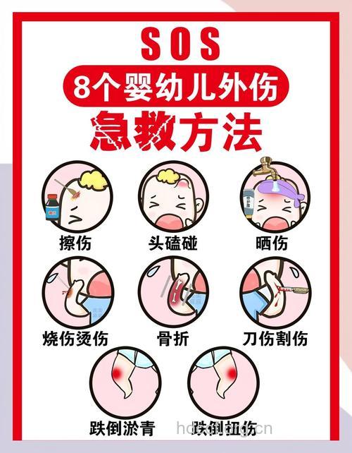 宝宝常见外伤急救方法