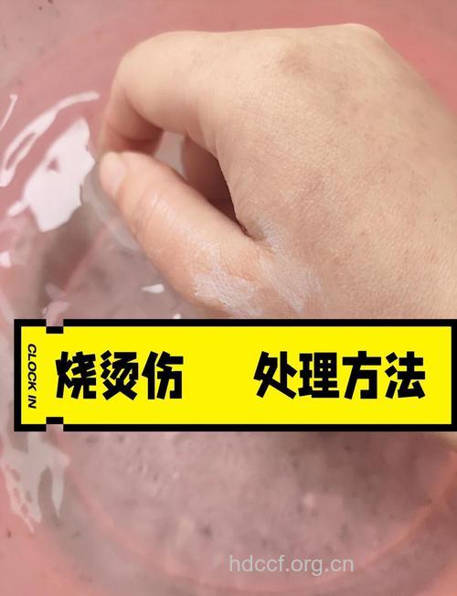轻度烫伤用葱叶来治