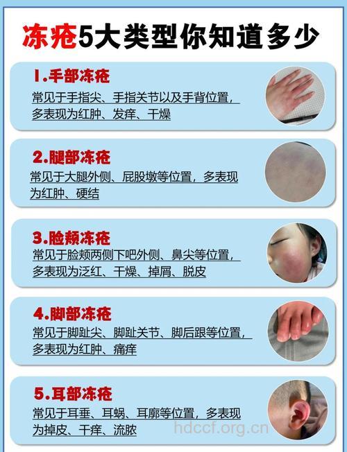 如何摆脱皮肤病困扰