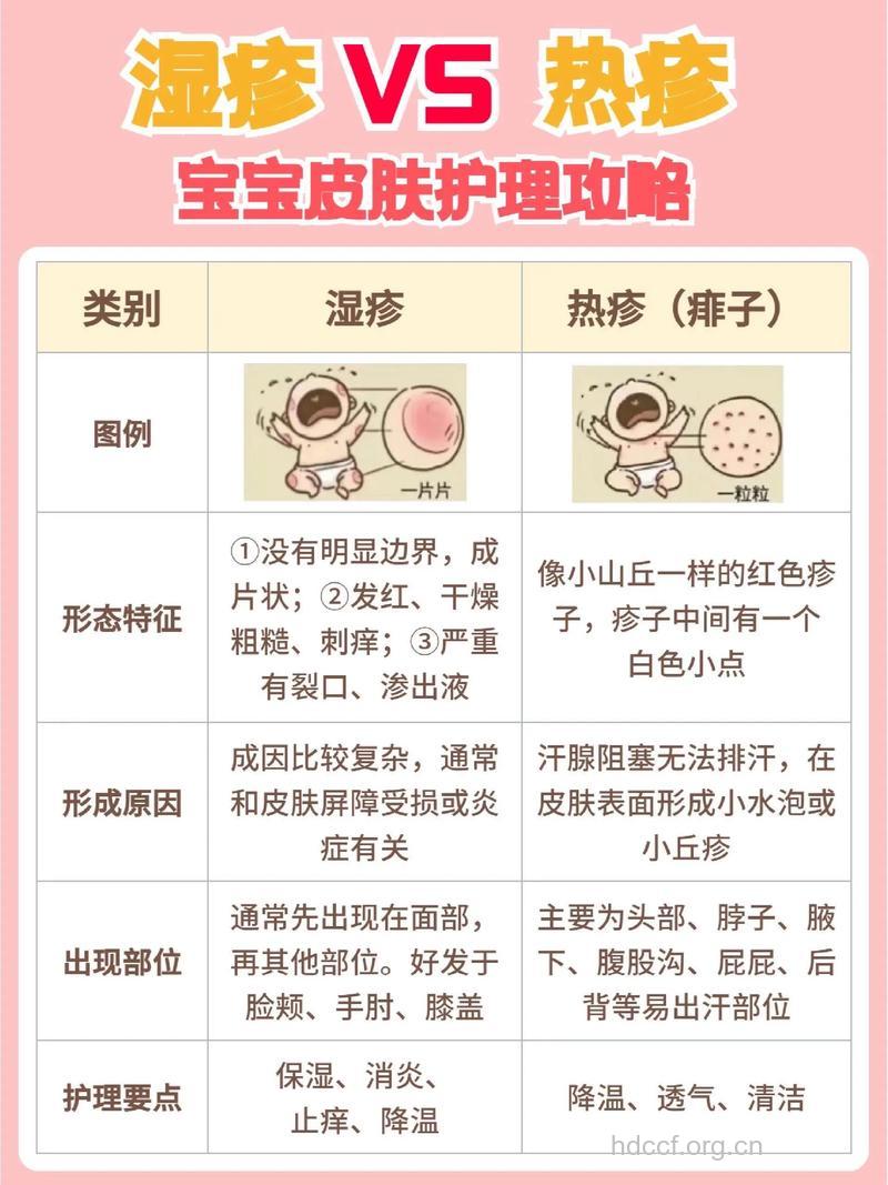 皮肤病患儿有什么护理要点