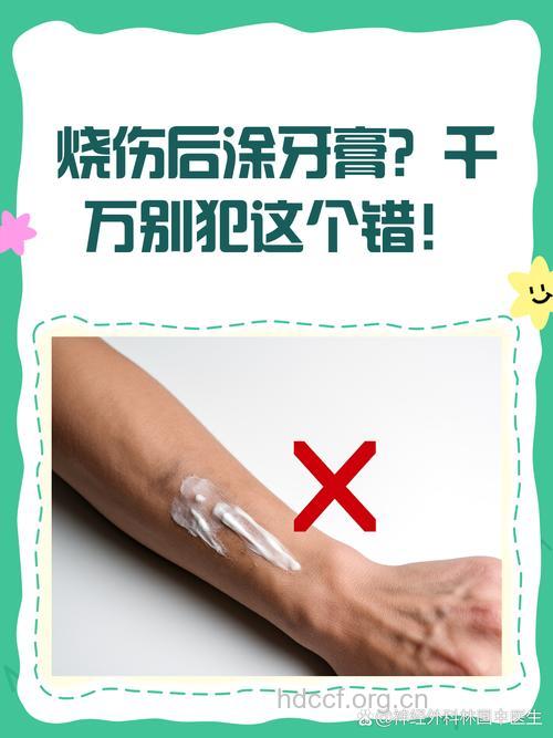 烫伤不可使用酱油、牙膏