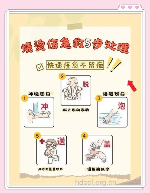 火灾应如何避免烧伤
