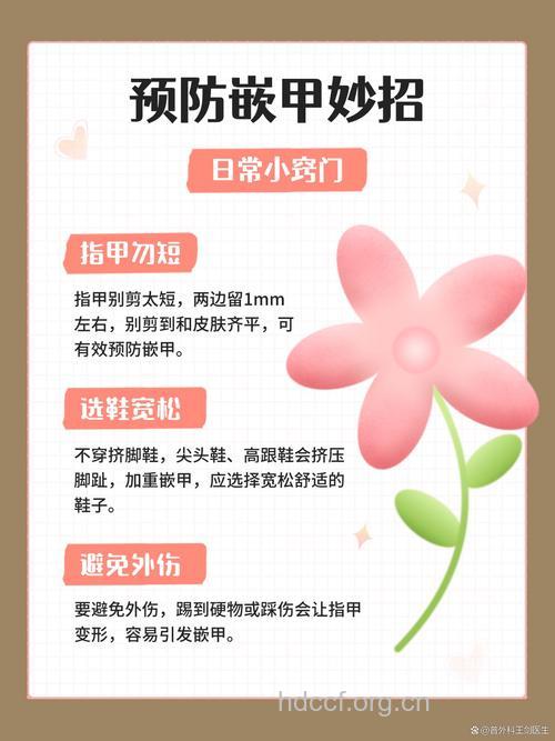 如何预防嵌甲?