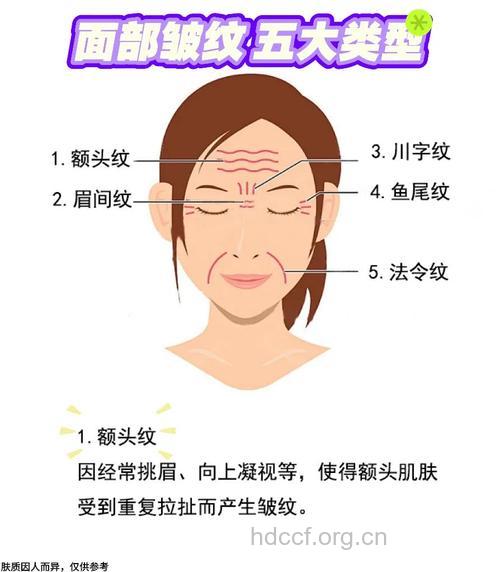 皱纹长的部位告诉你什么吗?