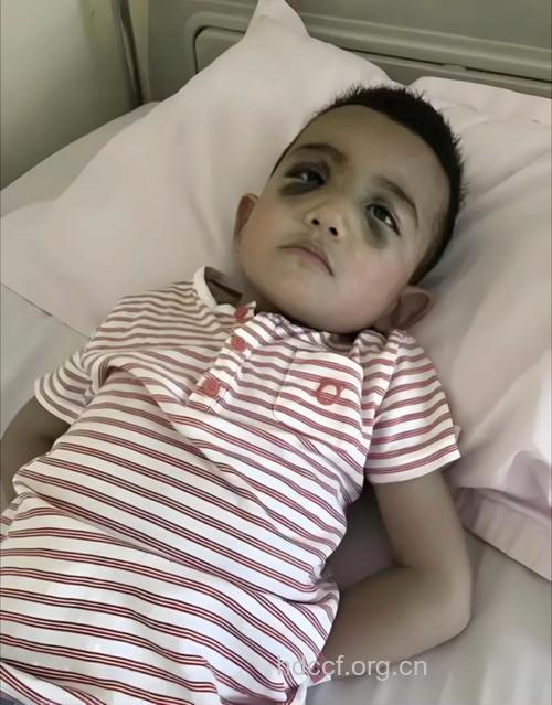 脾气暴躁、多动的孩子,需警惕铅中毒