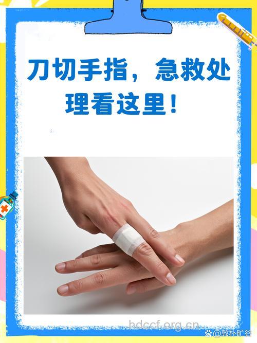 手指切伤的正确处理措施