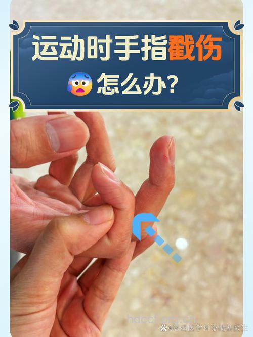 手指戳伤的4步急救法