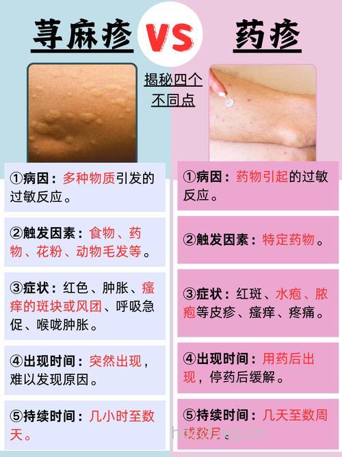 如何判断自己是不是药物过敏呢?