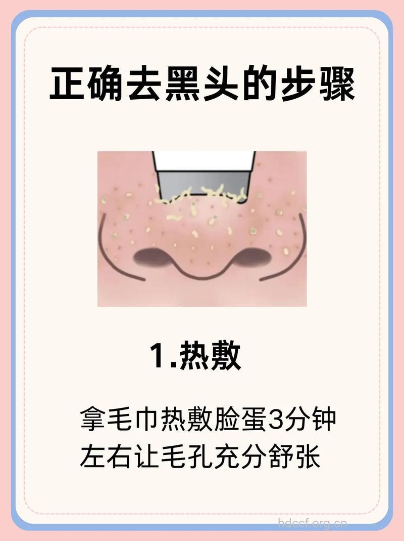 女性要如何祛除黑头?