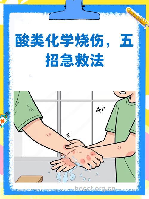 酸烧伤该怎么紧急处理?